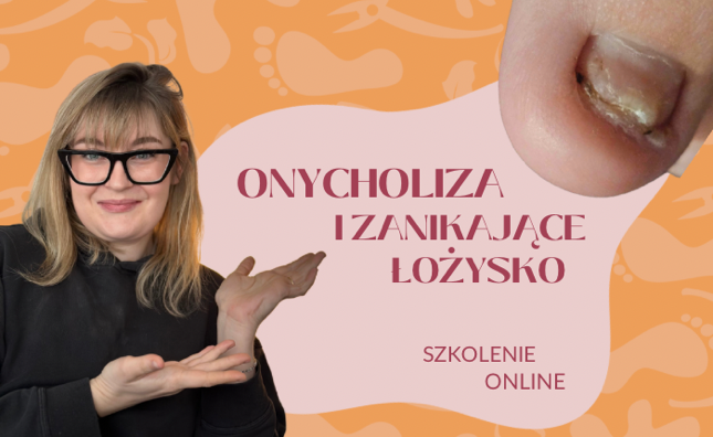 Onycholiza i zanikające łożysko